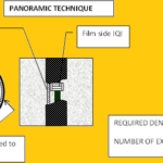Radiography procedure 1