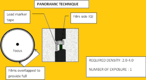 RT procedure
