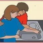 Small burn treatment