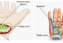 Carpal Tunnel: Anatomy, Function, and Related Conditions Carpal Tunnel: Anatomy, Function, and Related Conditions