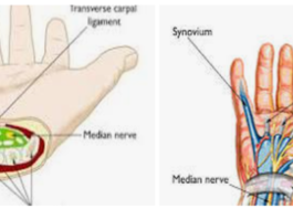 Carpal Tunnel: Anatomy, Function, and Related Conditions