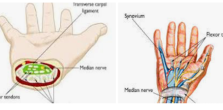 Carpal Tunnel: Anatomy, Function, and Related Conditions