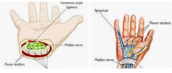 Carpal Tunnel: Anatomy, Function, and Related Conditions