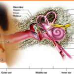 The Impact of Noise Exposure on Hearing Loss Risks and Preventative Measures